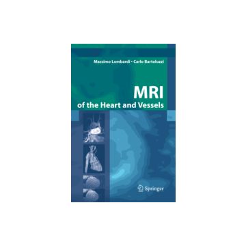 Mri Of The Heart And Vessels - Lombardi Massimo; Bartolozzi Carlo - Springer Verlag Italia - 9788847003064