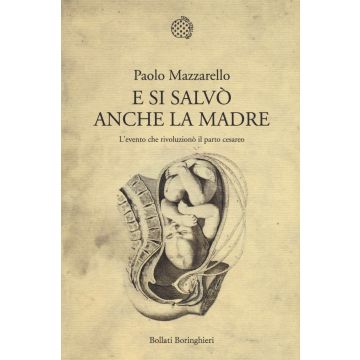 E si salvò anche la madre. L'evento che rivoluzionò il parto cesareo